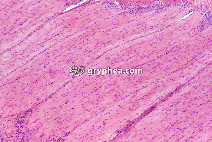 Fibres musculaires lisses x25 - gryphea.com